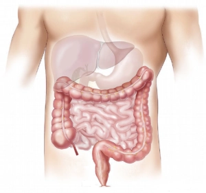 Illustrative image for bowel cancer