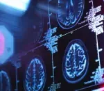 This is a feature image for blog article - Breakthrough Blood Test for Early Alzheimer's Detection at Roots Analysis
