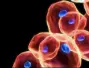 Europe Antibody Drug Conjugates Market by Target Indication (Breast Cancer, Non-Small Cell Lung Canc...